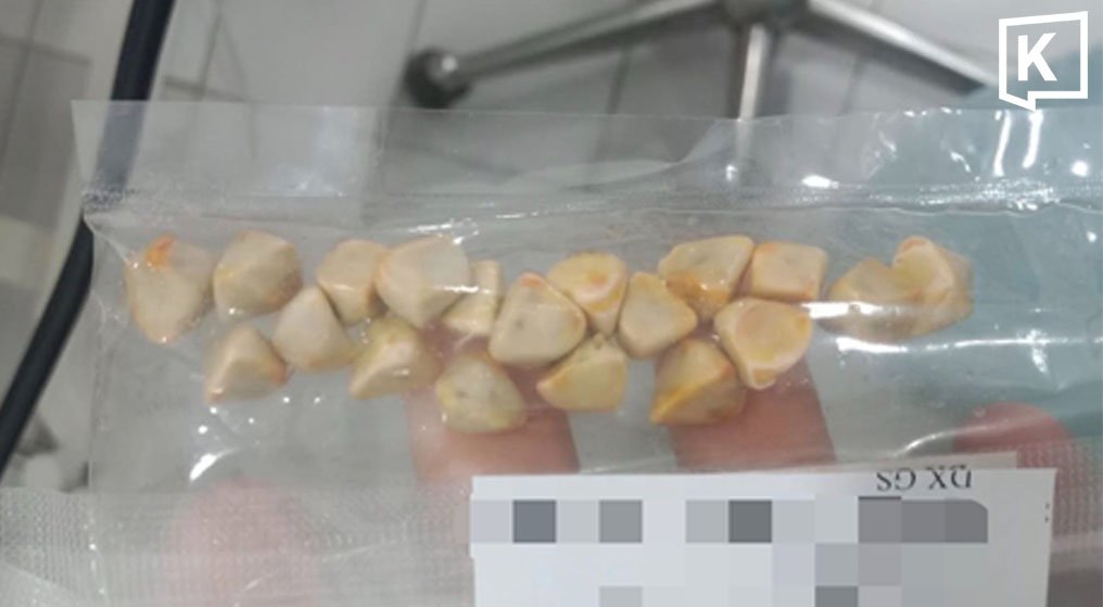Can Thai Iced Tea Cause Gallstones? Viral Post Highlights Unclear Health Claim
