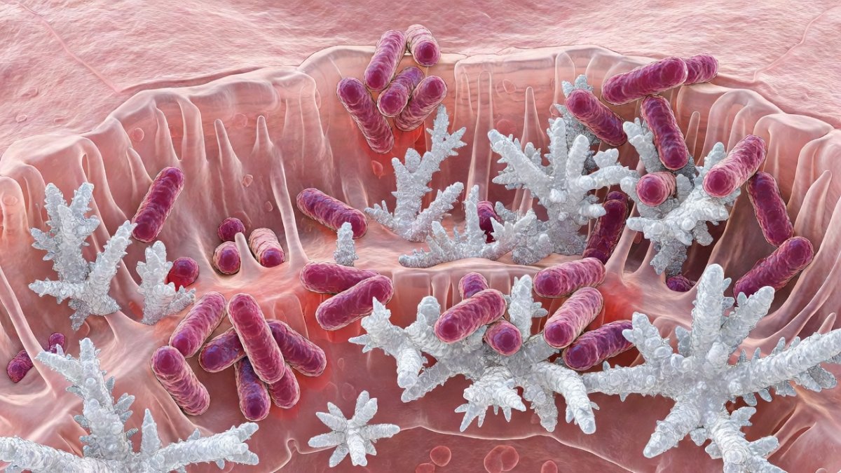 Scientists Discover a Hidden Heart Valve Risk Linked to Gum Disease