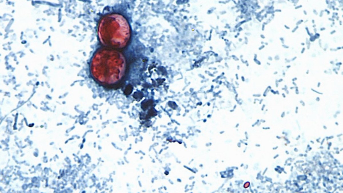 Cyclospora cayetanensis parasite magnified under a microscope, source of the 2026 outbreak