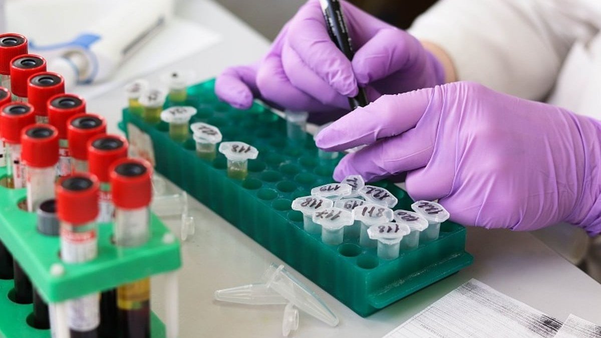 Laboratory testing scene for HIV awareness