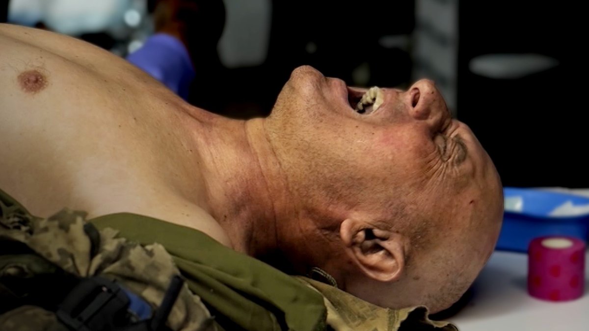 Inside Ukraine's Underground Hospital: The Drone War's New Front