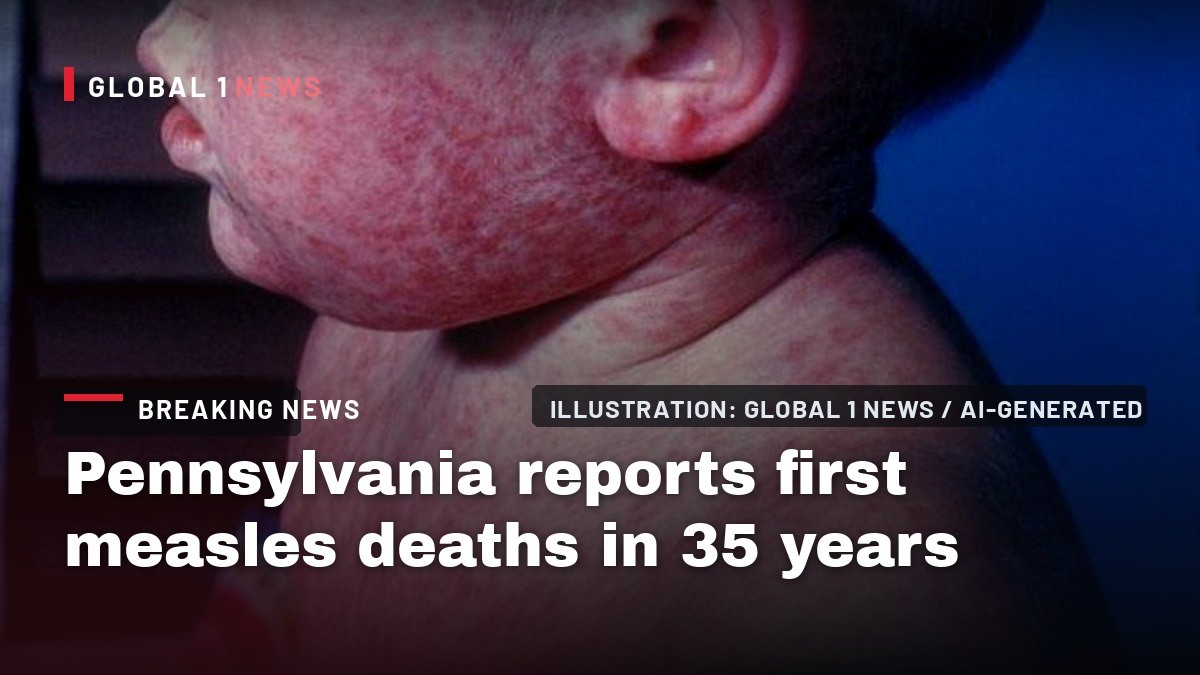 Pennsylvania reports first measles deaths in 35 years