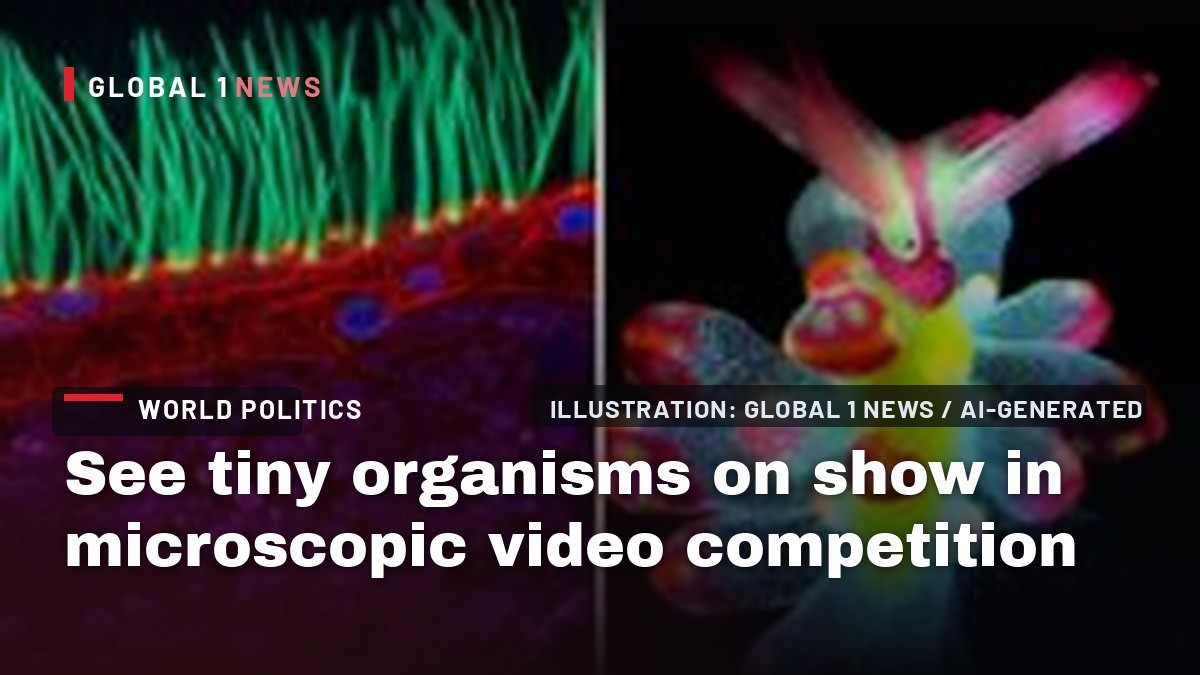 See tiny organisms on show in microscopic video competition