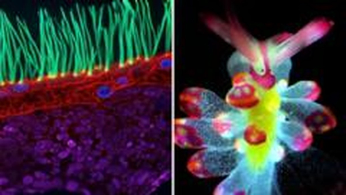 See tiny organisms on show in microscopic video competition