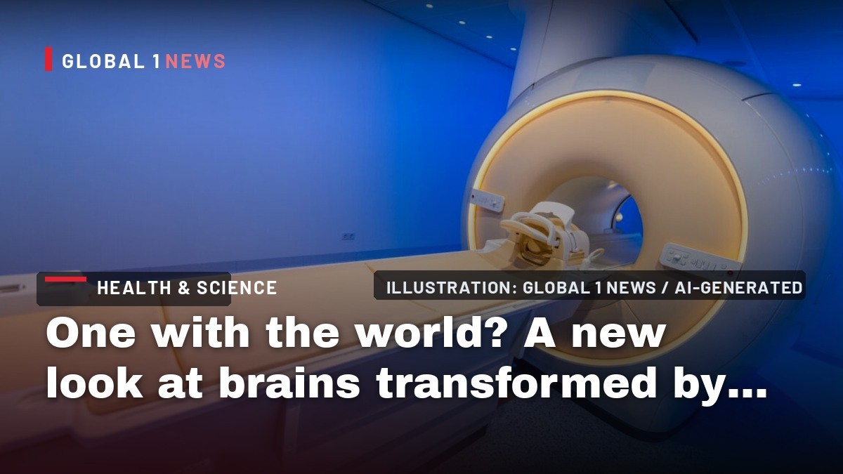 One with the world? A new look at brains transformed by psychedelics.
