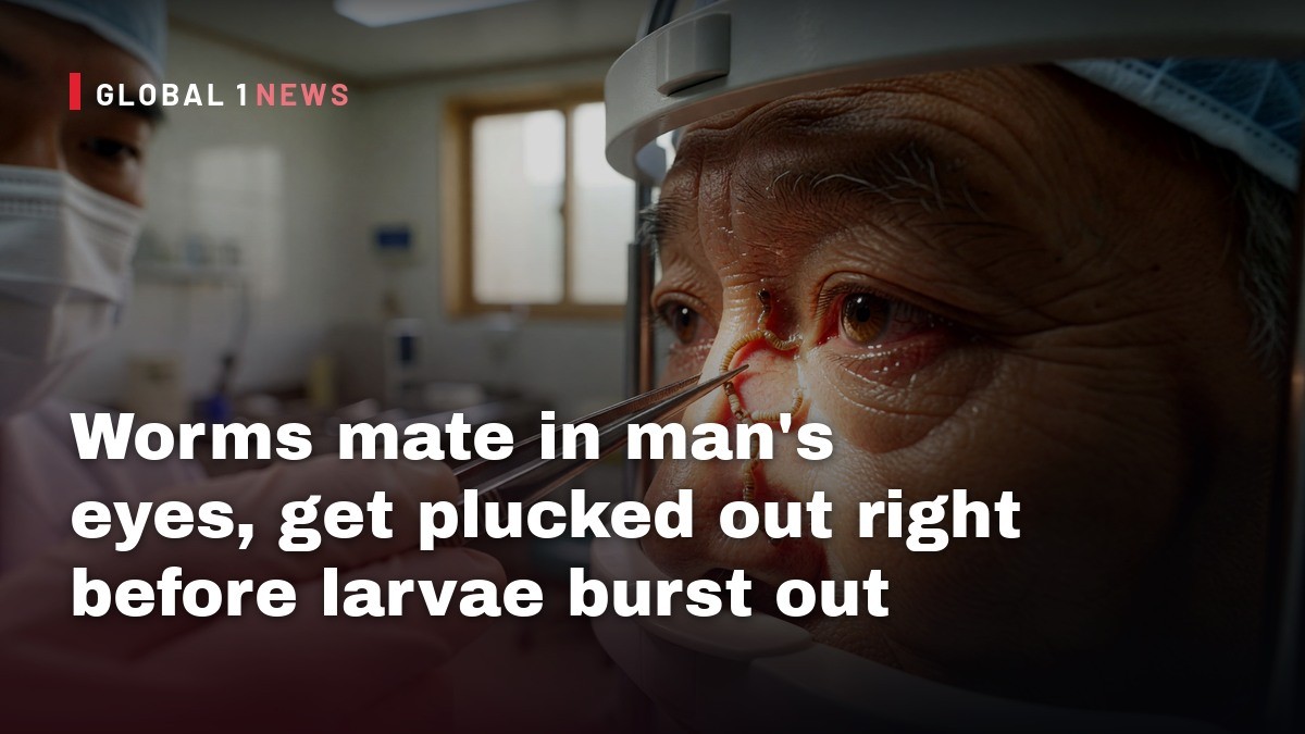 Worms mate in man's eyes, get plucked out right before larvae burst out